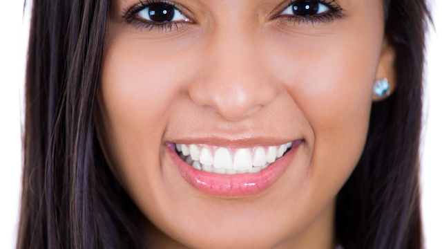 Shining Smiles: Unleashing the Power of Teeth Whitening Products