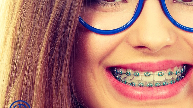 Straightening Smiles: Navigating Between Orthodontists and Private Dentists