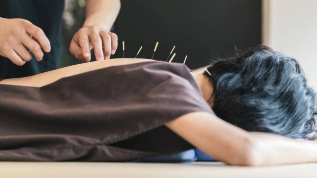 The Ancient Art of Needle Therapy: Unveiling the Wonders of Acupuncture