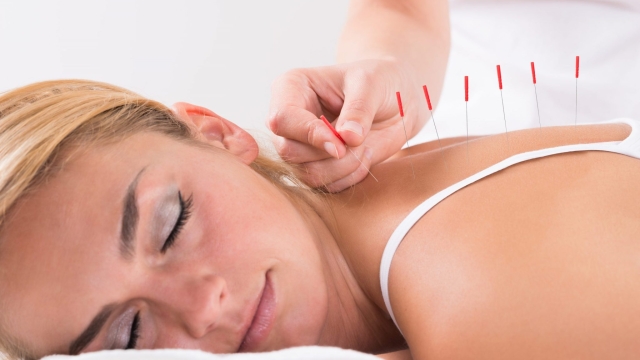 Needles of Relief: Unraveling the Magic of Acupuncture